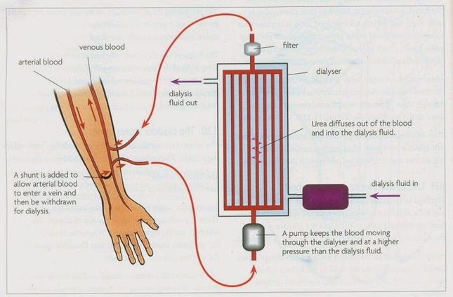 dialysis-biology-notes-for-igcse-2014